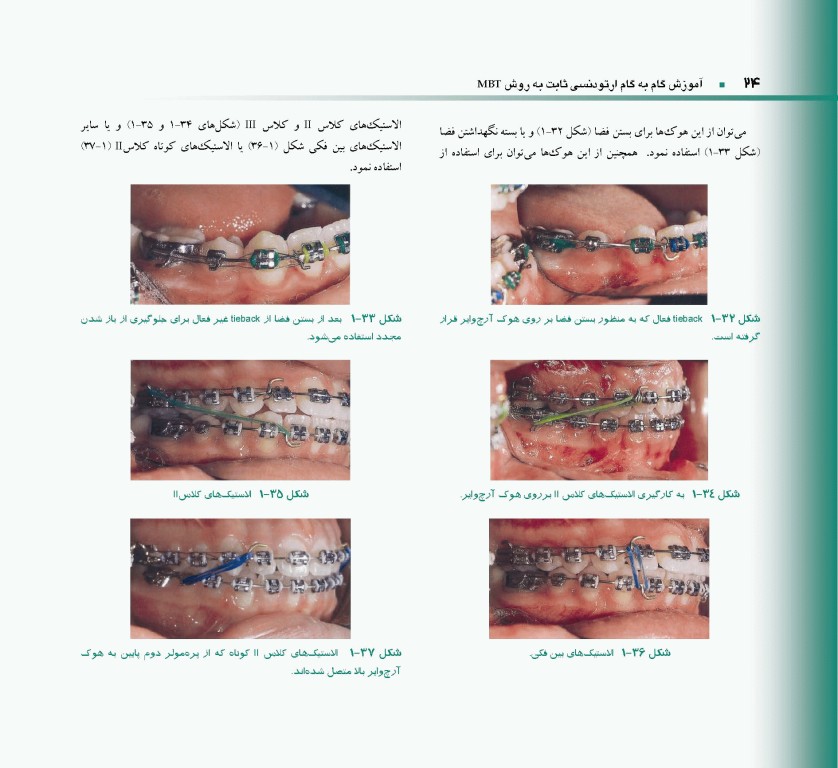 اصول و مبانی ارتودنسی ثابت به روش MBT دکتر حمید قنبری