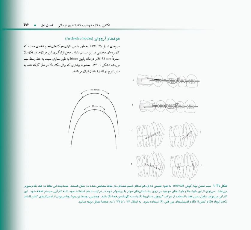 اصول و مبانی ارتودنسی ثابت به روش MBT دکتر حمید قنبری