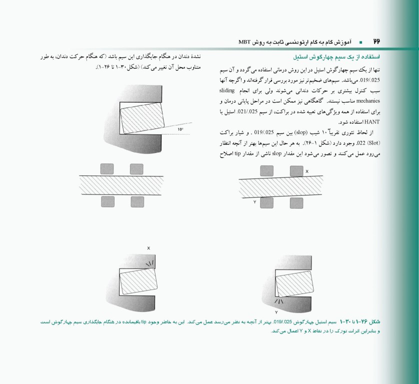 اصول و مبانی ارتودنسی ثابت به روش MBT دکتر حمید قنبری