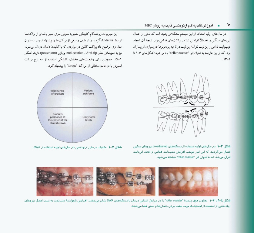 اصول و مبانی ارتودنسی ثابت به روش MBT دکتر حمید قنبری
