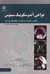 جراحی آندوسکوپیک سینوس آناتومی بازسازی سه بعدی و تکنیک جراحی
