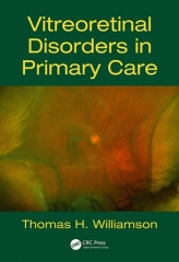اختلالات زجاجیه شبکیه در مراقبت‌های اولیه | Vitreoretinal Disorders in Primary Care