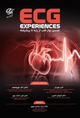 تفسیر نوار قلب ECG از پایه تا پیشرفته