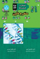 اختلال در کروموزوم‌ها سندروم داون