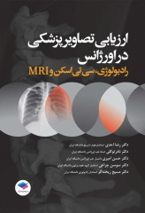 ارزیابی تصاویر پزشکی در اورژانس رادیولوژی، سی تی اسکن و MRI