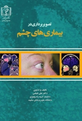 تصویربرداری در بیماری‌های چشم