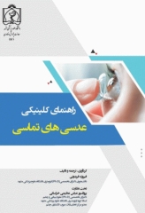 راهنمای کلینیکی عدسی‌های تماسی