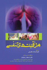 مراقبت‌های تنفسی